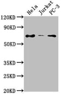 Western Blot
Positive WB detected in: Hela whole cell lysate, Jurkat whole cell lysate, PC-3 whole cell lysate
All lanes: PRICKLE3 antibody at 1:2000
Secondary
Goat polyclonal to rabbit IgG at 1/50000 dilution
Predicted band size: 69, 60 kDa
Observed band size: 69 kDa
