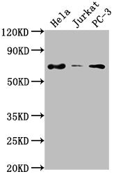 Western Blot
Positive WB detected in: Hela whole cell lysate, Jurkat whole cell lysate, PC-3 whole cell lysate
All lanes: PRICKLE3 antibody at 1:2000
Secondary
Goat polyclonal to rabbit IgG at 1/50000 dilution
Predicted band size: 69, 60 kDa
Observed band size: 69 kDa