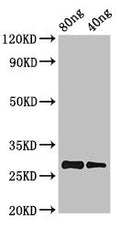 Western Blot
Positive WB detected in Recombinant protein
All lanes: PRL antibody at 2.8µg/ml
Secondary
Goat polyclonal to rabbit IgG at 1/50000 dilution
predicted band size: 28 kDa
observed band size: 28 kDa
