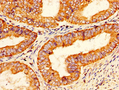 PROS1 Antibody, HRP conjugated – Figure 1 of 3