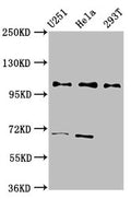 Western Blot
Positive WB detected in: U251 whole cell lysate, Hela whole cell lysate, 293T whole cell lysate
All lanes: PRPF40A antibody at 2.7ug/ml
Secondary
Goat polyclonal to rabbit IgG at 1/50000 dilution
Predicted band size: 109, 106, 107, 11 kDa
Observed band size: 109 kDa