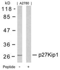 Western blot analysis of extracts from A2780 cells using p27Kip1(Ab-10