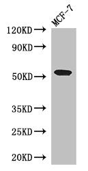Western Blot Positive WB detected in: MCF-7 whole cell lysate All lanes: PSEN1 antibody at 3ug/ml Secondary Goat polyclonal to rabbit IgG at 1/50000 dilution Predicted band size: 53, 43, 22, 47, 49 kDa Observed band size: 53 kDa