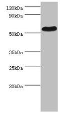 Western blot
All lanes: PSEN1 antibody at 2µg/ml + Hela whole cell lysate
Secondary
Goat polyclonal to rabbit IgG&nbsp;at 1/10000 dilution
Predicted band size: 53, 43, 22, 47, 49 kDa
Observed band size: 53 kDa