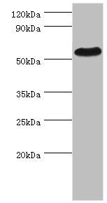 Western blot
All lanes: PSEN1 antibody at 2µg/ml + Hela whole cell lysate
Secondary
Goat polyclonal to rabbit IgG&nbsp;at 1/10000 dilution
Predicted band size: 53, 43, 22, 47, 49 kDa
Observed band size: 53 kDa
