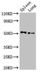 Western Blot
Positive WB detected in: Rat spleen tissue, Rat lung tissue
All lanes: PSEN2 antibody at 3ug/ml
Secondary
Goat polyclonal to rabbit IgG at 1/50000 dilution
Predicted band size: 51, 47 kDa
Observed band size: 51 kDa
