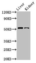 Western Blot
Positive WB detected in: Rat liver tissue, Rat kidney tissue
All lanes: PTGER4 antibody at 3.2ug/ml
Secondary
Goat polyclonal to rabbit IgG at 1/50000 dilution
Predicted band size: 54 kDa
Observed band size: 54 kDa