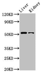 Western Blot
Positive WB detected in: Rat liver tissue, Rat kidney tissue
All lanes: PTGER4 antibody at 3.2ug/ml
Secondary
Goat polyclonal to rabbit IgG at 1/50000 dilution
Predicted band size: 54 kDa
Observed band size: 54 kDa