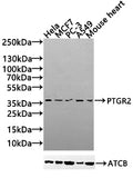 Western Blot
Positive WB detected in: Hela whole cell lysate(30µg), MCF7 whole cell lysate(30µg), PC-3 whole cell lysate(30µg), A549 whole cell lysate(20µg),Mouse Heart tissue lysate(30µg)
All lanes:PTGR2 antibody at 1:1000
Secondary
Goat polyclonal to rabbit IgG at 1/20000 dilution
Predicted band size: 39,20 kDa
Observed band size: 39 kDa
Exposure time: 120s