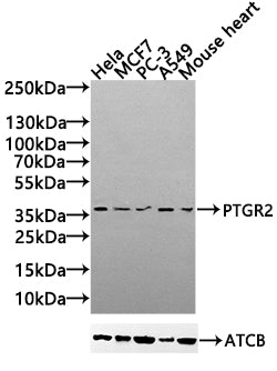 Western Blot
Positive WB detected in: Hela whole cell lysate(30µg), MCF7 whole cell lysate(30µg), PC-3 whole cell lysate(30µg), A549 whole cell lysate(20µg),Mouse Heart tissue lysate(30µg)
All lanes:PTGR2 antibody at 1:1000
Secondary
Goat polyclonal to rabbit IgG at 1/20000 dilution
Predicted band size: 39,20 kDa
Observed band size: 39 kDa
Exposure time: 120s