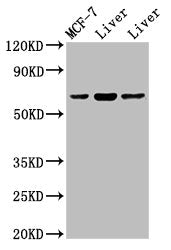 Western Blot
Positive WB detected in: Rat liver tissue, Mouse liver issue
All lanes: PTH1R antibody at 2ug/ml
Secondary
Goat polyclonal to rabbit IgG at 1/50000 dilution
Predicted band size: 67 kDa
Observed band size: 67 kDa