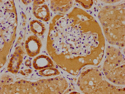 IHC image of CSB-PA018996LA01HU diluted at 1:100 and staining in paraffin-embedded human kidney tissue performed on a Leica BondTM system. After dewaxing and hydration, antigen retrieval was mediated by high pressure in a citrate buffer (pH 6.0). Section was blocked with 10% normal goat serum 30min at RT. Then primary antibody (1% BSA) was incubated at 4°C overnight. The primary is detected by a biotinylated secondary antibody and visualized using an HRP conjugated SP system.