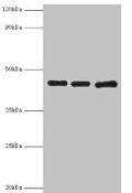 Western blot
All lanes: Poliovirus receptor antibody at 3ug/ml
Lane 1: Mouse gonad tissue
Lane 2: HepG2 whole cell lysate
Lane 3: K562 whole cell lysate
Secondary
Goat polyclonal to rabbit IgG at 1/10000 dilution
Predicted band size: 46, 41, 40, 43 kDa
Observed band size: 46 kDa