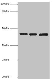Western blot
All lanes: Poliovirus receptor antibody at 3ug/ml
Lane 1: Mouse gonad tissue
Lane 2: HepG2 whole cell lysate
Lane 3: K562 whole cell lysate
Secondary
Goat polyclonal to rabbit IgG at 1/10000 dilution
Predicted band size: 46, 41, 40, 43 kDa
Observed band size: 46 kDa