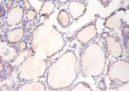 ADAM15 Antibody, HRP conjugated – Figure 1 of 1