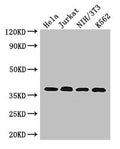 Western Blot Positive WB detected in: Hela whole cell lysate, Jurkat whole cell lysate, NIH/3T3 whole cell lysate, K562 whole cell lysate All lanes: RAD51 antibody at 2.7µg/ml Secondary Goat polyclonal to rabbit IgG at 1/50000 dilution Predicted band size: 37, 27, 32 kDa Observed band size: 37 kDa