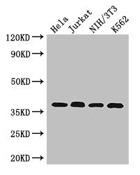 Western Blot Positive WB detected in: Hela whole cell lysate, Jurkat whole cell lysate, NIH/3T3 whole cell lysate, K562 whole cell lysate All lanes: RAD51 antibody at 2.7µg/ml Secondary Goat polyclonal to rabbit IgG at 1/50000 dilution Predicted band size: 37, 27, 32 kDa Observed band size: 37 kDa
