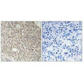Immunohistochemistry analysis of paraffin-embedded human prostate carcinoma tissue using AMOTL1 antibody.