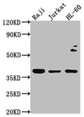 Western Blot
Positive WB detected in: Raji whole cell lysate, Jurkat whole cell lysate, HL-60 whole cell lysate
All lanes: RASSF2 antibody at 1:2000
Secondary
Goat polyclonal to rabbit IgG at 1/50000 dilution
Predicted band size: 38, 18 kDa
Observed band size: 38 kDa