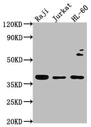 Western Blot
Positive WB detected in: Raji whole cell lysate, Jurkat whole cell lysate, HL-60 whole cell lysate
All lanes: RASSF2 antibody at 1:2000
Secondary
Goat polyclonal to rabbit IgG at 1/50000 dilution
Predicted band size: 38, 18 kDa
Observed band size: 38 kDa