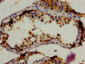 Immunohistochemistry of paraffin-embedded human testis tissue using CSB-PA019480YA01HU at dilution of 1:100