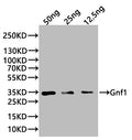 Western Blot
Positive WB detected in: recombinant protein
All lanes:Gnf1 Antibody at 1:1000
Secondary
Goat polyclonal to rabbit IgG at 1/20000 dilution
Predicted band size: 32 kDa
Observed band size: 34 kDa