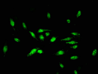 Immunofluorescent analysis of Hela cells using CSB-PA01959A0Rb at dilution of 1:100 and Alexa Fluor 488-congugated AffiniPure Goat Anti-Rabbit IgG(H+L)