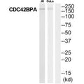 Western blot analysis of extracts from Jurkat/COLO205 cells, using MRCKa antibody.