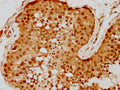 IHC image of CSB-PA019805LA01HU diluted at 1:300 and staining in paraffin-embedded human testis tissue performed on a Leica BondTM system. After dewaxing and hydration, antigen retrieval was mediated by high pressure in a citrate buffer (pH 6.0). Section was blocked with 10% normal goat serum 30min at RT. Then primary antibody (1% BSA) was incubated at 4°C overnight. The primary is detected by a biotinylated secondary antibody and visualized using an HRP conjugated SP system.