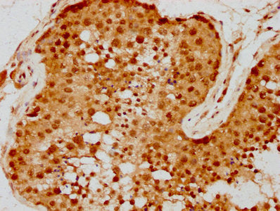IHC image of CSB-PA019805LA01HU diluted at 1:300 and staining in paraffin-embedded human testis tissue performed on a Leica BondTM system. After dewaxing and hydration, antigen retrieval was mediated by high pressure in a citrate buffer (pH 6.0). Section was blocked with 10% normal goat serum 30min at RT. Then primary antibody (1% BSA) was incubated at 4°C overnight. The primary is detected by a biotinylated secondary antibody and visualized using an HRP conjugated SP system.