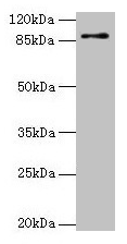 Western blot
All lanes: RNF10 antibody at 4µg/ml + Mouse brain tissue
Secondary
Goat polyclonal to rabbit IgG at 1/10000 dilution
Predicted band size: 90, 91 kDa
Observed band size: 90 kDa