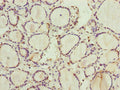 Immunohistochemistry of paraffin-embedded human thyroid tissue using CSB-PA019816ESR1HU at dilution of 1:100