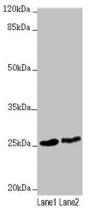 Western blot All lanes: RNF114 antibody at 1.63µg/ml Lane 1: 293T whole cell lysate Lane 2: HepG2 whole cell lysate Secondary Goat polyclonal to rabbit IgG at 1/10000 dilution Predicted band size: 26, 22 kDa Observed band size: 26 kDa