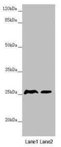 Western blot All lanes: RNF114 antibody at 0.87µg/ml Lane 1: Mouse gonadal tissue Lane 2: 293T whole cell lysate Secondary Goat polyclonal to rabbit IgG at 1/10000 dilution Predicted band size: 26, 22 kDa Observed band size: 26 kDa