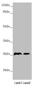 Western blot All lanes: RNF114 antibody at 0.87µg/ml Lane 1: Mouse gonadal tissue Lane 2: 293T whole cell lysate Secondary Goat polyclonal to rabbit IgG at 1/10000 dilution Predicted band size: 26, 22 kDa Observed band size: 26 kDa