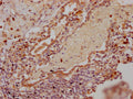 IHC image of CSB-PA019825LA01HU diluted at 1:300 and staining in paraffin-embedded human lung tissue performed on a Leica BondTM system. After dewaxing and hydration, antigen retrieval was mediated by high pressure in a citrate buffer (pH 6.0). Section was blocked with 10% normal goat serum 30min at RT. Then primary antibody (1% BSA) was incubated at 4°C overnight. The primary is detected by a Goat anti-rabbit polymer IgG labeled by HRP and visualized using 0.05% DAB.