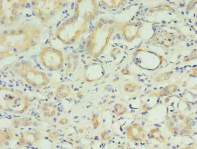 RNF183 Antibody, FITC conjugated – Figure 1 of 2