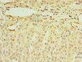 Immunohistochemistry of paraffin-embedded human adrenal gland tissue using CSB-PA019872ESR2HU at dilution of 1:100
