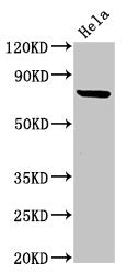 Western Blot
Positive WB detected in: Hela whole cell lysate
All lanes: RNF219 antibody at 4ug/ml
Secondary
Goat polyclonal to rabbit IgG at 1/50000 dilution
Predicted band size: 81 kDa
Observed band size: 81 kDa