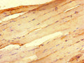 Immunohistochemistry of paraffin-embedded human skeletal muscle tissue using CSB-PA019889LA01HU at dilution of 1:100