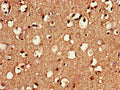Immunohistochemistry of paraffin-embedded human brain tissue using CSB-PA019890LA01HU at dilution of 1:100
