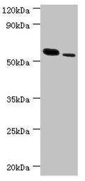 Western blot
All lanes: RNF8 antibody at 11µg/ml
Lane 1: Hela whole cell lysate
Lane 2: 293T whole cell lysate
Secondary
Goat polyclonal to rabbit IgG at 1/10000 dilution
Predicted band size: 56, 11, 51 kDa
Observed band size: 56 kDa