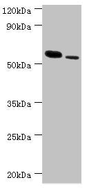 Western blot
All lanes: RNF8 antibody at 11µg/ml
Lane 1: Hela whole cell lysate
Lane 2: 293T whole cell lysate
Secondary
Goat polyclonal to rabbit IgG at 1/10000 dilution
Predicted band size: 56, 11, 51 kDa
Observed band size: 56 kDa