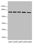 Western blot
All lanes: SDHA antibody at 10µg/ml
Lane 1: Rat heart tissue
Lane 2: Mouse spleen tissue
Lane 3: Mouse liver tissue
Lane 4: Hela whole cell lysate
Lane 5: Zebrafish lysate
Secondary
Goat polyclonal to rabbit IgG at 1/10000 dilution
Predicted band size: 73, 68, 57 kDa
Observed band size: 73 kDa