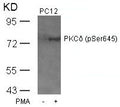 Western blot analysis of extracts from PC12 cells untreated or treated with PMA using PKCd(Phospho-Ser645) Antibody.