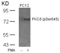 Western blot analysis of extracts from PC12 cells untreated or treated with PMA using PKCd(Phospho-Ser645) Antibody.