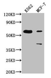 Western BlotPositive WB detected in: K562 whole cell lysate, MCF-7 whole cell lysateAll lanes: PTBP3 antibody at 1:2000SecondaryGoat polyclonal to rabbit IgG at 1/50000 dilutionPredicted band size: 60, 57, 61, 50 kDaObserved band size: 60 kDa