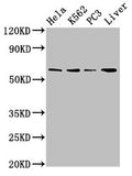 Western Blot
Positive WB detected in: Hela whole cell lysate, K562 whole cell lysate, PC-3 whole cell lysate, Mouse liver tissue
All lanes: RORA antibody at 2.7ug/ml
Secondary
Goat polyclonal to rabbit IgG at 1/50000 dilution
Predicted band size: 59, 64, 62, 54 kDa
Observed band size: 59 kDa