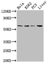 Western Blot
Positive WB detected in: Hela whole cell lysate, K562 whole cell lysate, PC-3 whole cell lysate, Mouse liver tissue
All lanes: RORA antibody at 2.7ug/ml
Secondary
Goat polyclonal to rabbit IgG at 1/50000 dilution
Predicted band size: 59, 64, 62, 54 kDa
Observed band size: 59 kDa