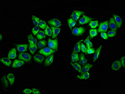 Immunofluorescence staining of Hela cells with CSB-PA020072LA01HU at 1:133, counter-stained with DAPI. The cells were fixed in 4% formaldehyde, permeabilized using 0.2% Triton X-100 and blocked in 10% normal Goat Serum. The cells were then incubated with the antibody overnight at 4°C. The secondary antibody was Alexa Fluor 488-congugated AffiniPure Goat Anti-Rabbit IgG(H+L).